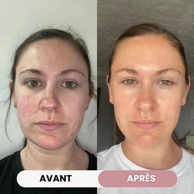Crème au Collagène